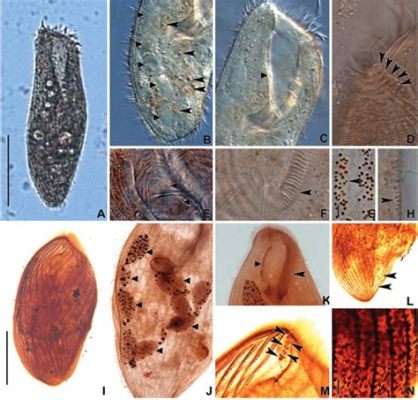  Condylostoma: ¿Es este ciliado realmente un experto en la construcción de casas microscópicas?